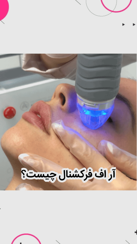 آر اف فرکشنال چیست؟ مزایا، معایب و مراقبت + هزینه